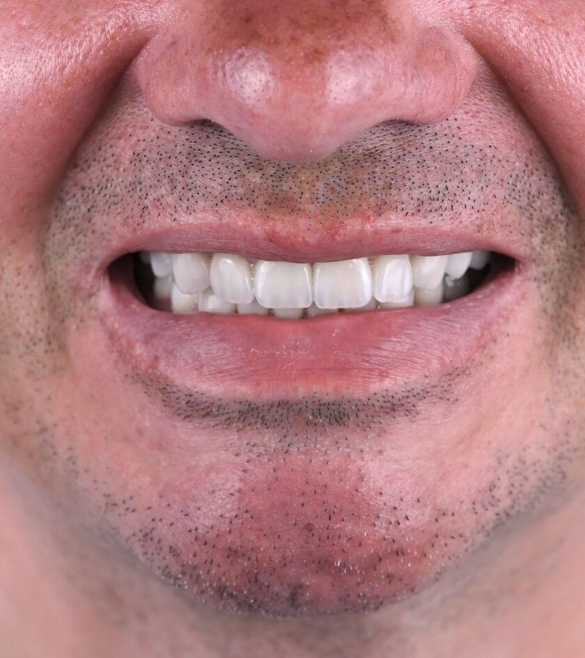 Pēc ārstēšanas: no plānošanas līdz pārliecībai