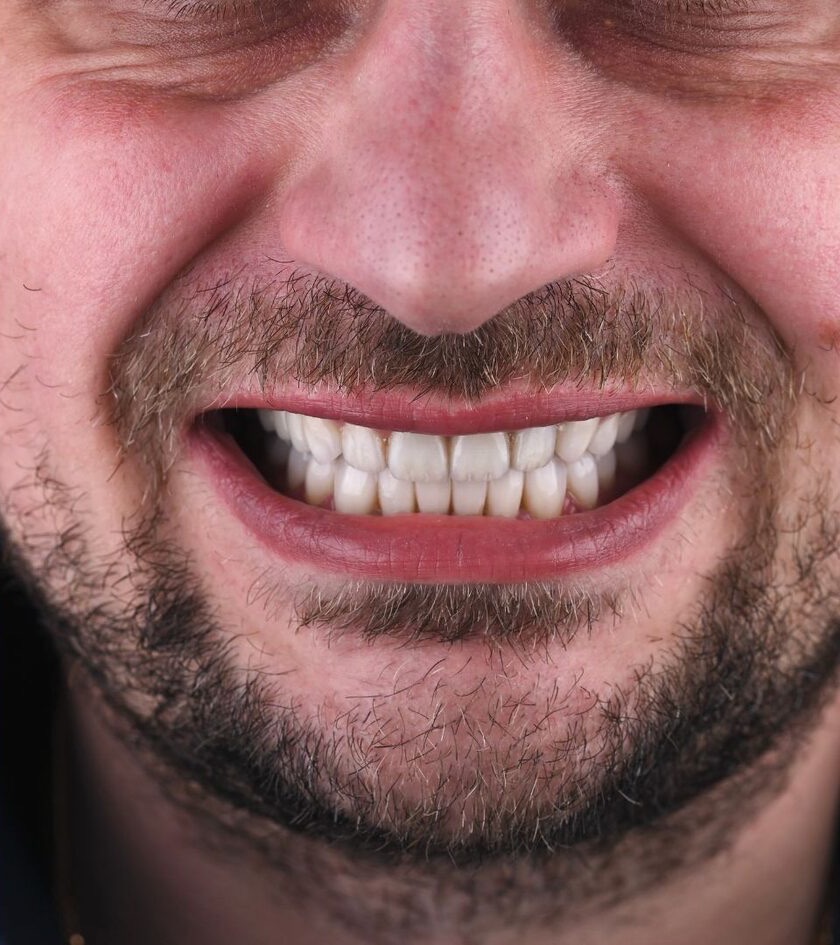 Pēc ārstēšanas: pārdomāta pieeja divos mēnešos
